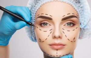 Benefits of cosmetic surgery